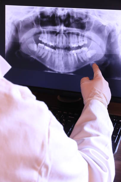 Best Emergency Dental Care for Broken or Chipped Teeth in Gordo, AL